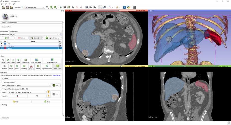 AI-assisted segmentation using NVidia Clara